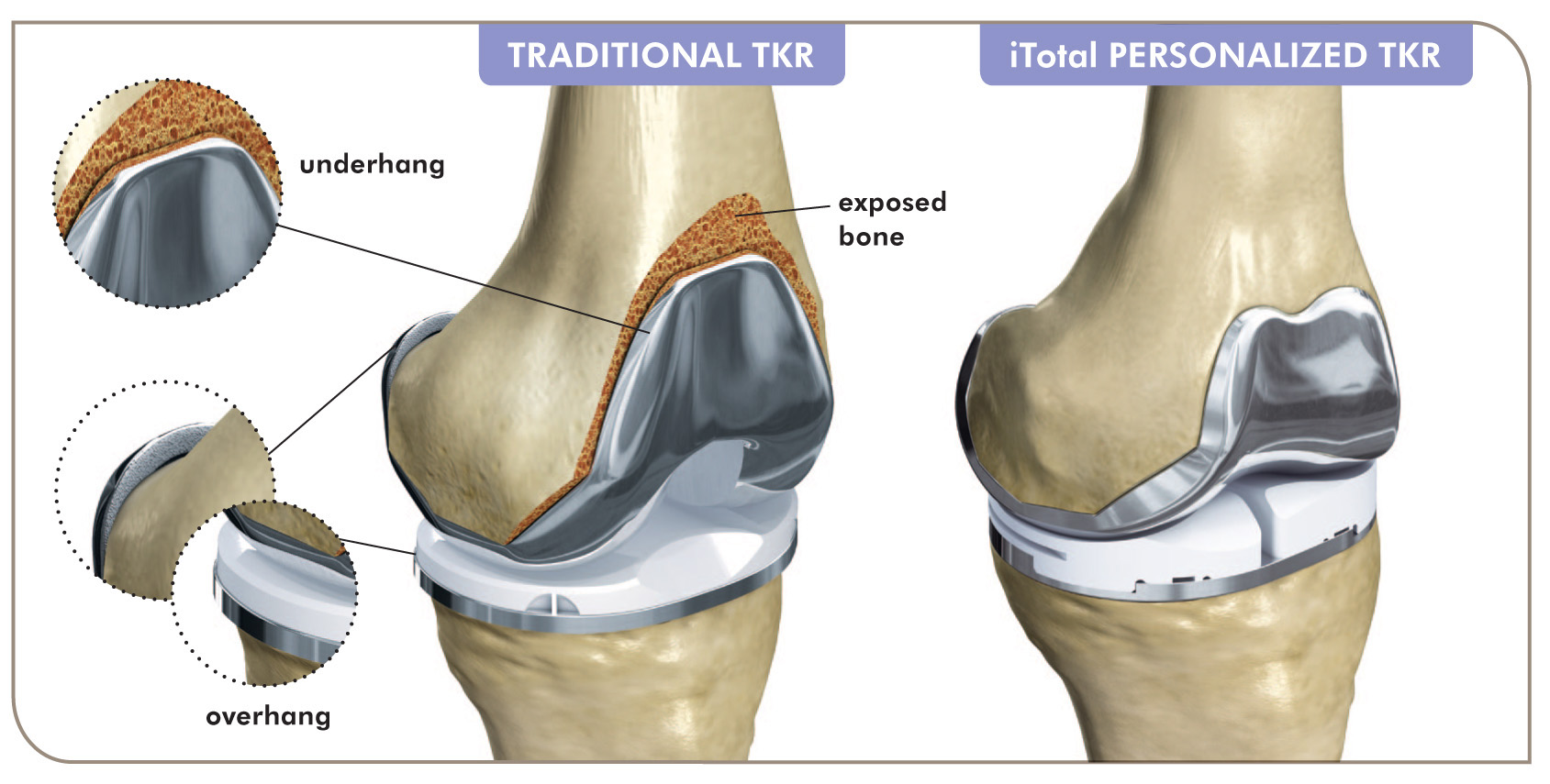 iTotal vs._TKR1