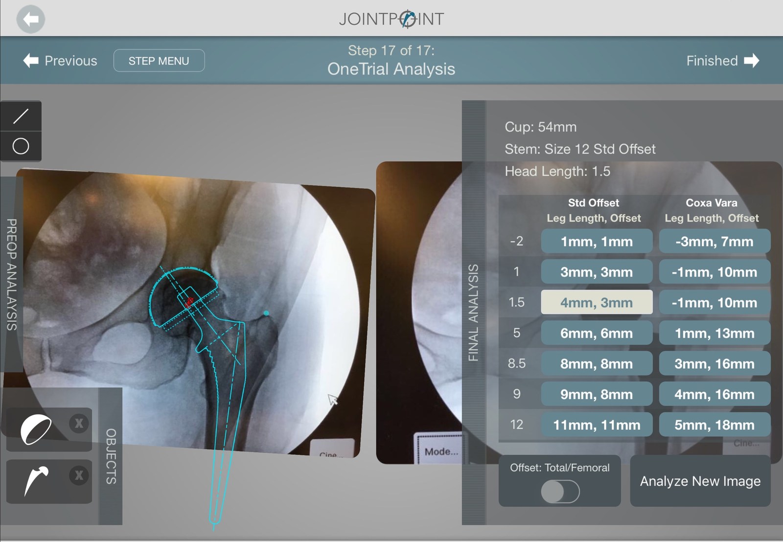 DePuy Synthes OneTrial