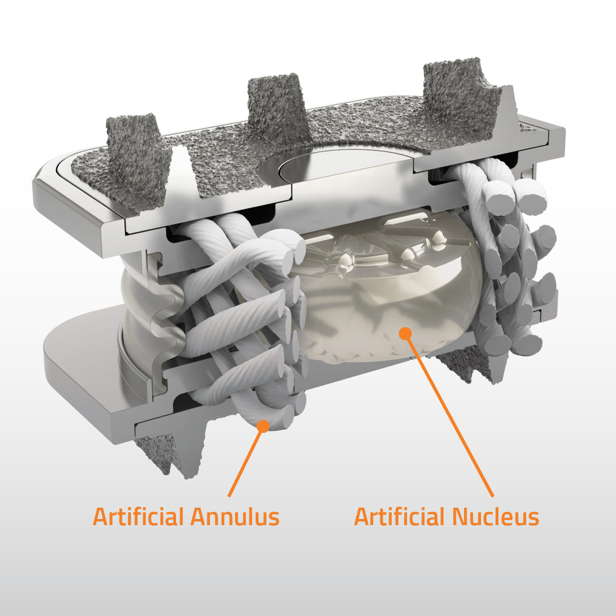 orthofix m6 c cut away