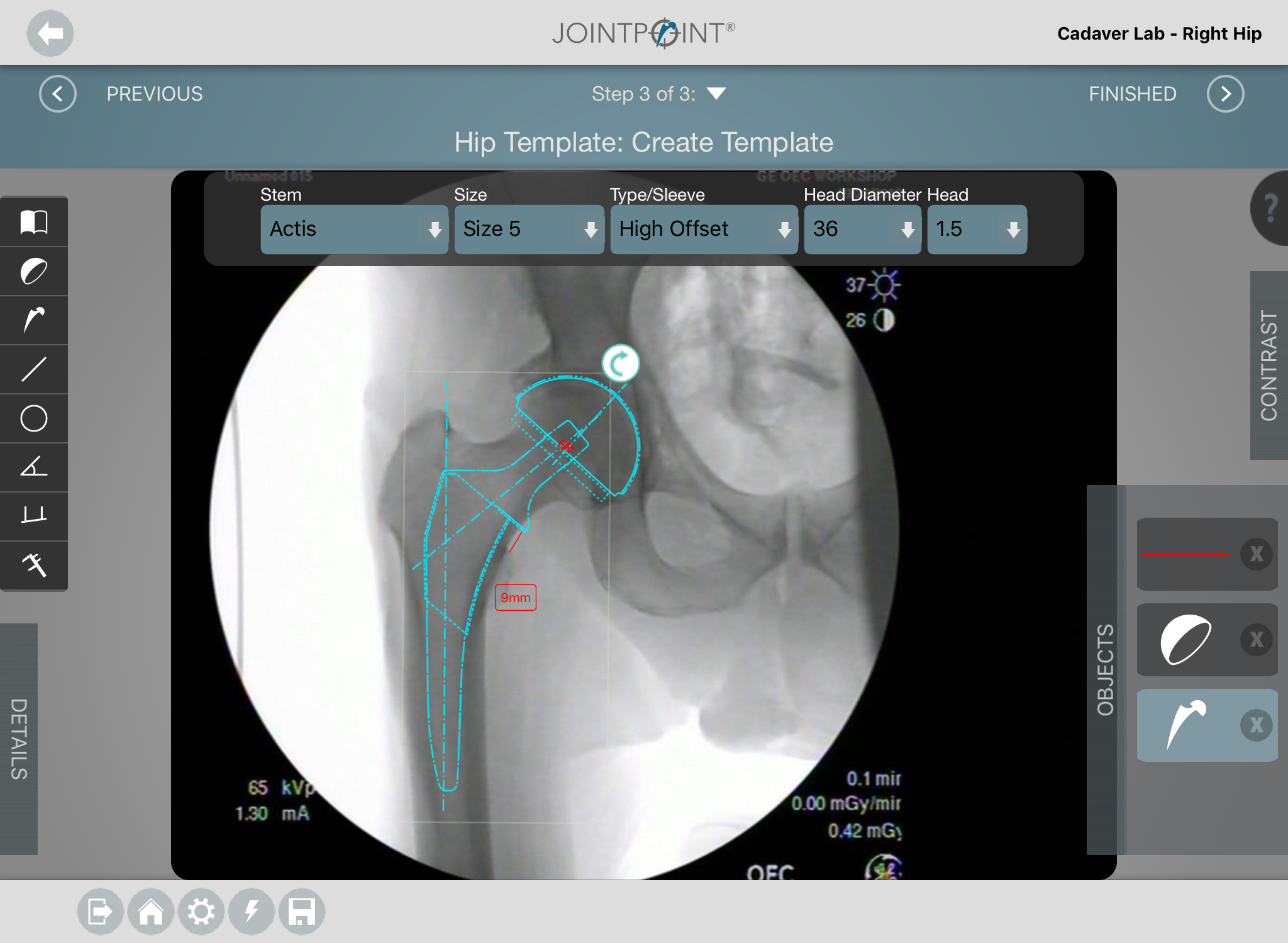 DePuy Synthes JointPoint