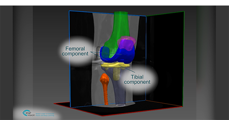 RSIP Vision Segmentation