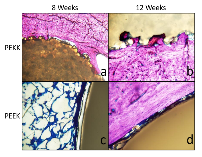 Exhibit OPM OsteoFab in vivo bone response
