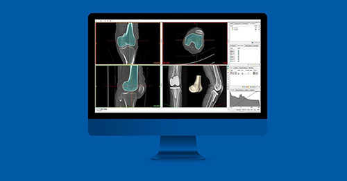 Materialise Mimics