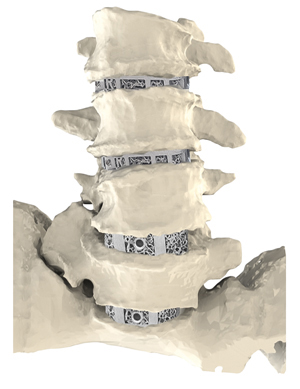 Canary Medical reduced