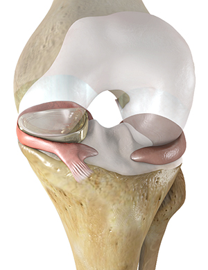 Canary Medical reduced