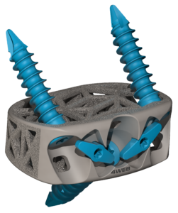 4WEB Medical STAND ALONE ANTERIOR SPINE TRUSS SYSTEM™