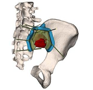 3D-Side 3D-Cut PSI
