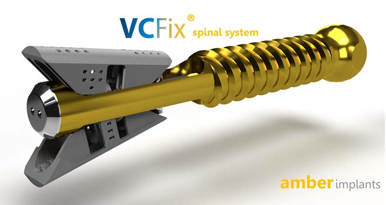 Amber Implants VCFix Spinal System