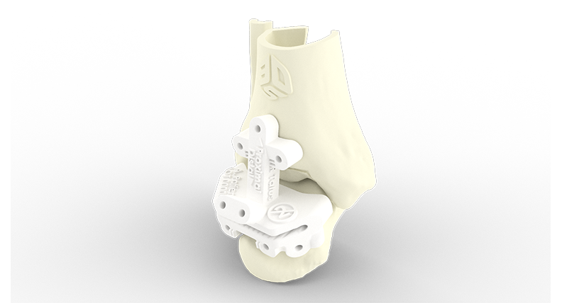 3D Systems Healthcare Vantage Ankle PSI Guide