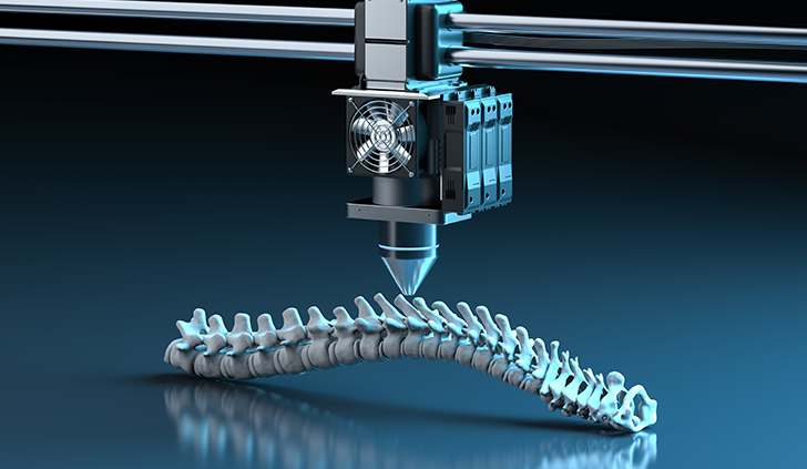 3D-Printed PEEK/Silicon Nitride Scaffolds with a Triply Periodic Minimal  Surface Structure for Spinal Fusion Implants