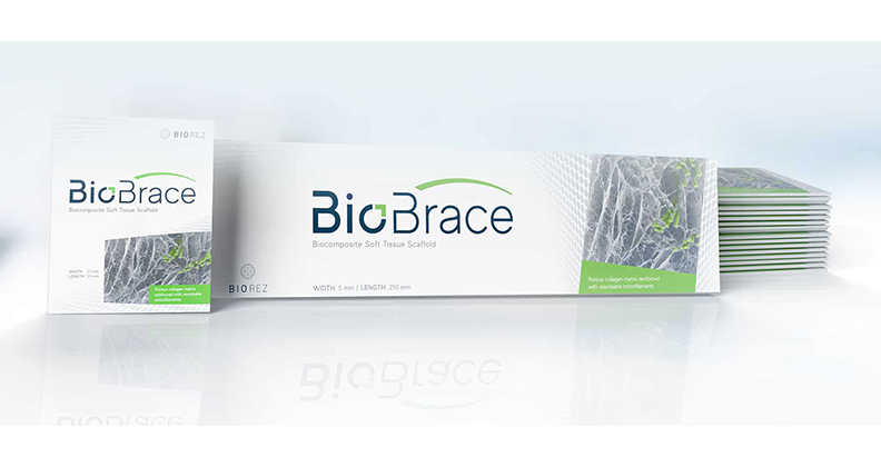 CONMED to Acquire Biorez and BioBrace Implant Technology