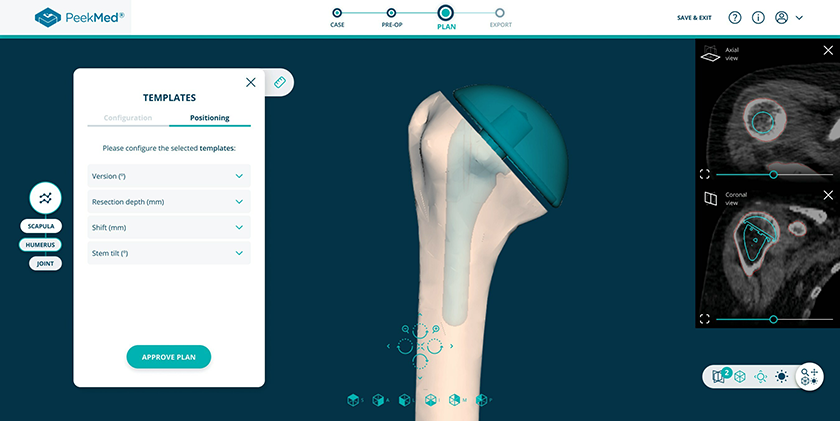 PeekMed Automated Orthopedic Solutions