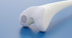 BioPoly Knee System