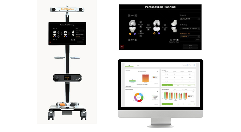 Smith+Nephew CORI Surgical System