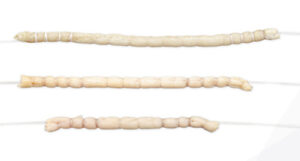 AlloSource AceConnex Pre-Sutured Fascia