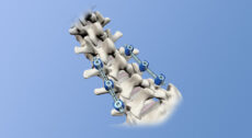 ZimVie Vital Spinal Fixation System
