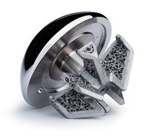 Zimmer Biomet | OsseoFit Stemless Shoulder