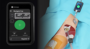 OrthAlign | Lantern Hip