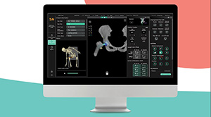 Smith+Nephew | CORIOGRAPH Pre-Op Planning and Modeling Services