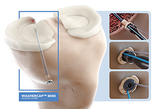 ABANZA WasherCap Mini