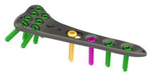 OrthoNovis BPS Wrist Fracture System