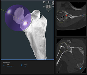 Precision AI Surgical Planning System