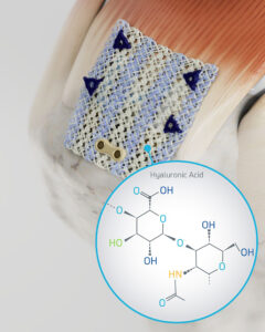 Anika Therapeutics Integrity Implant