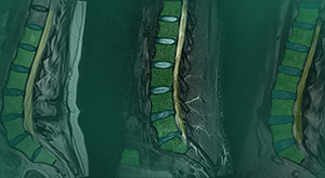 MSKai Spine Imaging Software