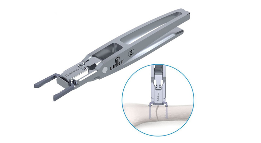 Trax Surgical Earns FDA 510(k) Clearance for Nitinol Staple