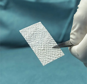 Kerecis Tendon Protect