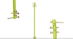 Smith+Nephew TRIGEN MAX Tibial Nail