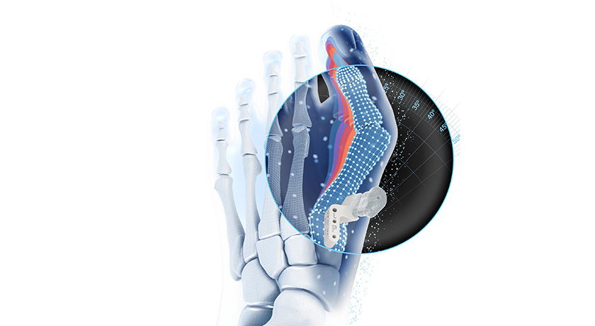J&J MedTech VIRTUGUIDE