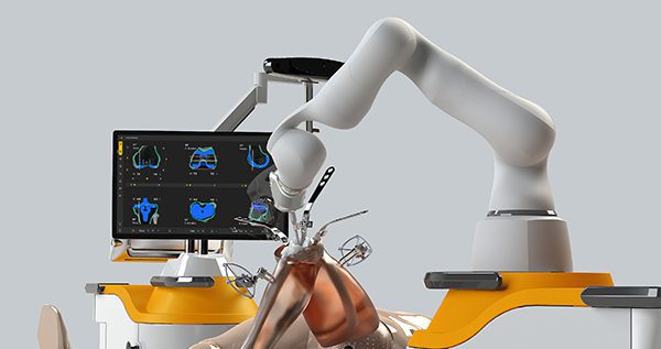 Monogram Marks First Autonomous Saw-Based Robotic Knee Replacement