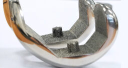 Croom Medical Introduces Biofuse™ 3D-Printed Lattice Technology for Orthopedic Implants