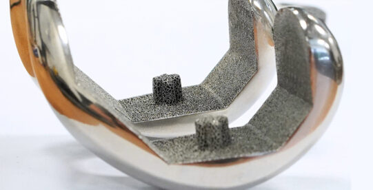 Croom Medical Introduces Biofuse™ 3D-Printed Lattice Technology for Orthopedic Implants