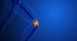 stock image of the knee joint glowing