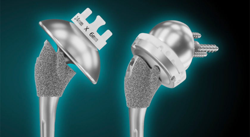 Shoulder Innovations Inset 70