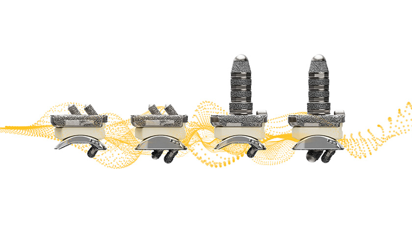 Stryker Incompass Total Ankle