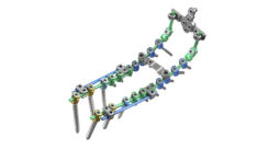 ulrich medical Cortium Universal OCT Spinal Fixation