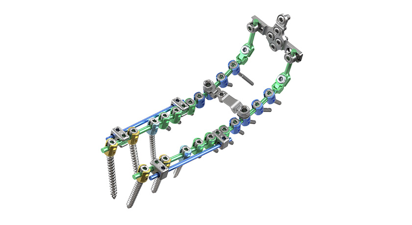 ulrich medical Cortium Universal OCT Spinal Fixation