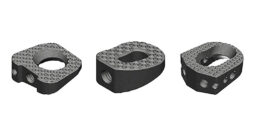SINTX SiNAPTIC Foot & Ankle Osteotomy Wedges