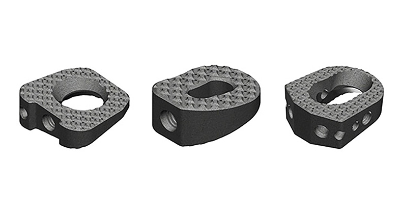 SINTX SiNAPTIC Foot & Ankle Osteotomy Wedges