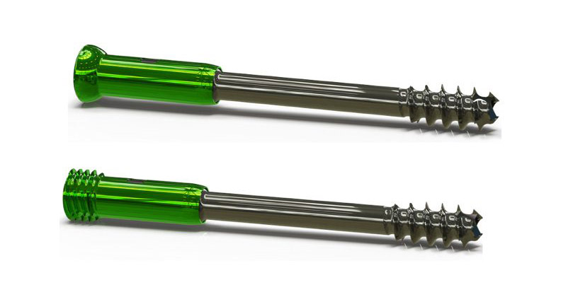 Dynamic Compression Screws from the University of Utah