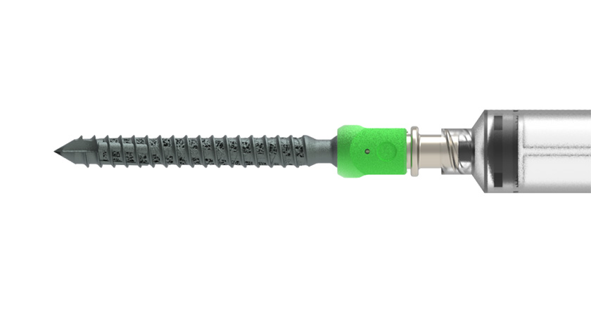 ALLUMIN8 A8 INTEGR8 Pedicle Screw