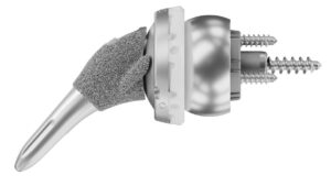 Shoulder Innovations' Inset Stem