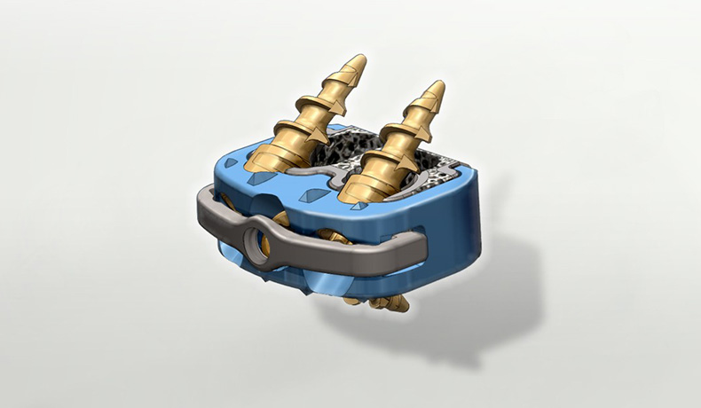 Lincotek Medical SpineLinc