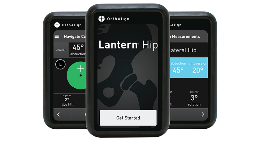 OrthAlign Lantern Hip