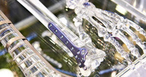 Carpenter Technology's BIODUR 108