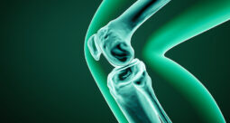 Concept art showing the bones of the knee inside a leg with a green tint