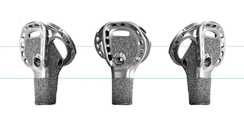 Catalyst OrthoScience’s Catalyst Fracture Shoulder System